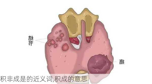 积非成是的近义词,积成的意思